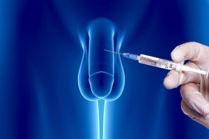 Erectile Dysfunction