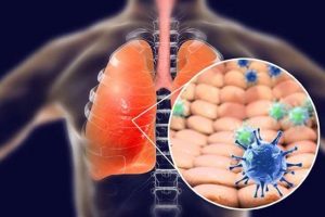 Coronavirus