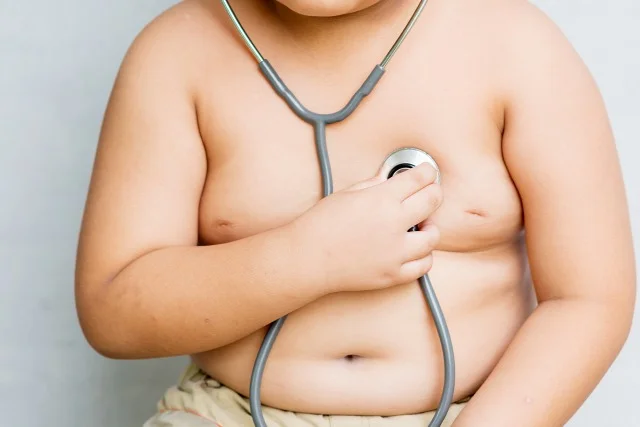 Childhood Obesity in Florida